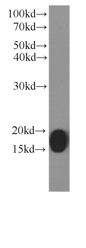 HEK-293 cells were subjected to SDS PAGE followed by western blot with Catalog No:107172(COXIV antibody) at dilution of 1:1000