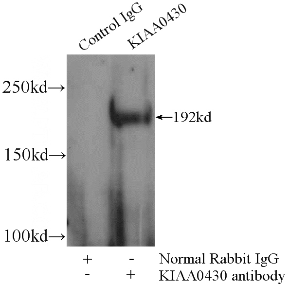 IP Result of anti-KIAA0430 (IP:Catalog No:111981, 5ug; Detection:Catalog No:111981 1:300) with HeLa cells lysate 2000ug.