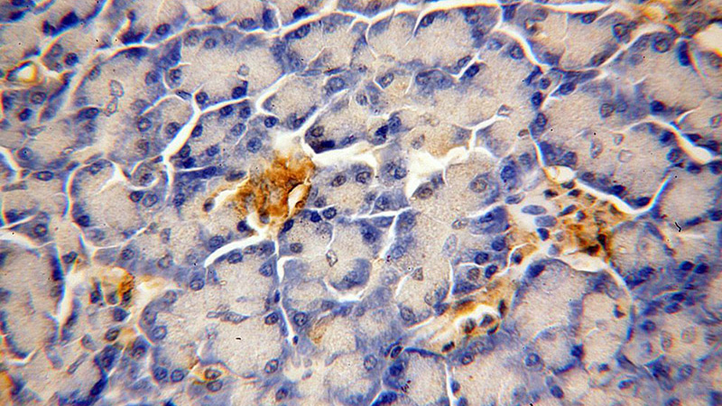 Immunohistochemical of paraffin-embedded human pancreas using Catalog No:110368(ERO1L antibody) at dilution of 1:50 (under 40x lens)