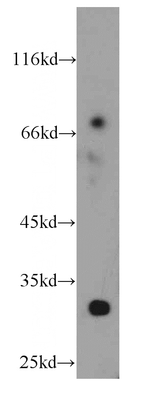 mouse ovary tissue were subjected to SDS PAGE followed by western blot with Catalog No:111989(KIAA1191 antibody) at dilution of 1:200