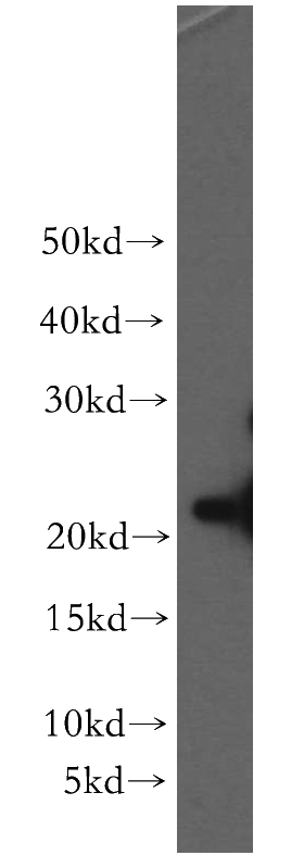 HeLa cells were subjected to SDS PAGE followed by western blot with Catalog No:115155(SFT2D3 antibody) at dilution of 1:300