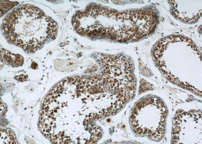 Immunohistochemistry of paraffin-embedded human testis tissue slide using Catalog No:110080(DNAH14 Antibody) at dilution of 1:50 (under 10x lens)
