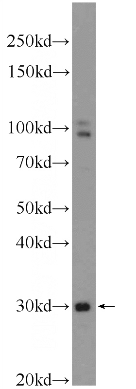 DU 145 cells were subjected to SDS PAGE followed by western blot with Catalog No:116506(TXNDC11 Antibody) at dilution of 1:1000