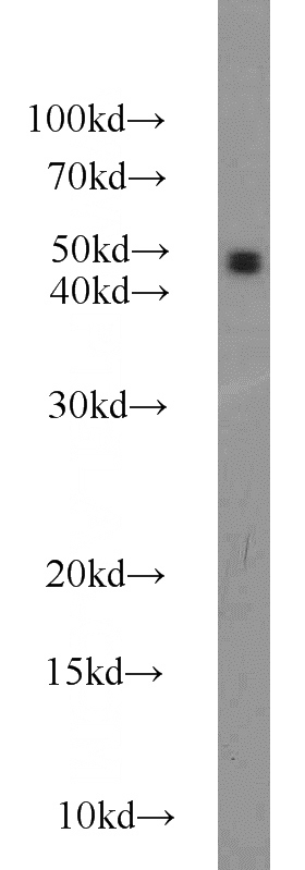 HepG2 cells were subjected to SDS PAGE followed by western blot with Catalog No:112493(MAT2A antibody) at dilution of 1:500
