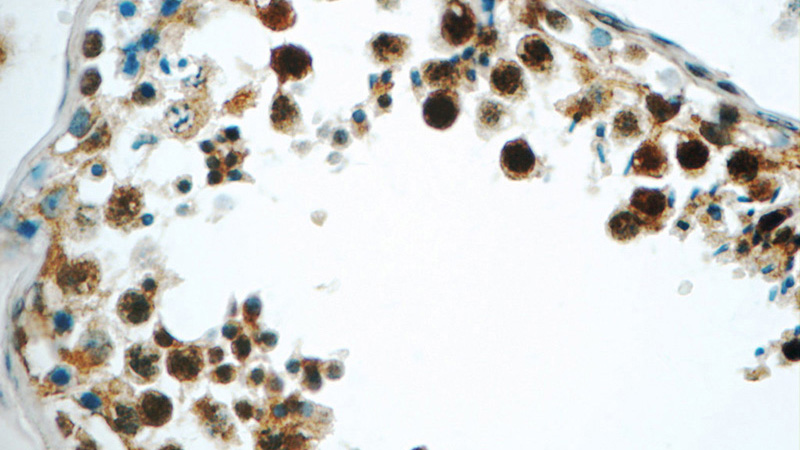 Immunohistochemistry of paraffin-embedded human testis tissue slide using Catalog No:113685(PCBP2 Antibody) at dilution of 1:50 (under 40x lens)
