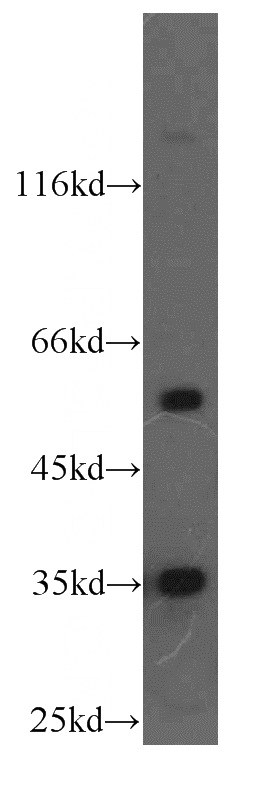 HeLa cells were subjected to SDS PAGE followed by western blot with Catalog No:112185(LDHB antibody) at dilution of 1:300