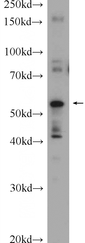 mouse lung tissue were subjected to SDS PAGE followed by western blot with Catalog No:107813(ABHD15 Antibody) at dilution of 1:300