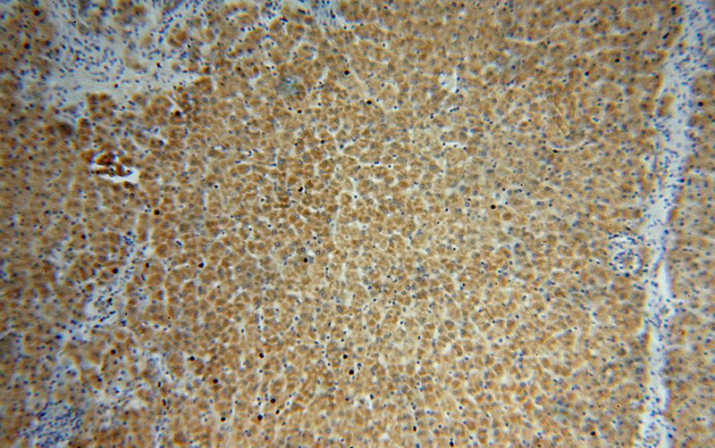 Immunohistochemical of paraffin-embedded human liver using Catalog No:115840(SUOX antibody) at dilution of 1:100 (under 10x lens)
