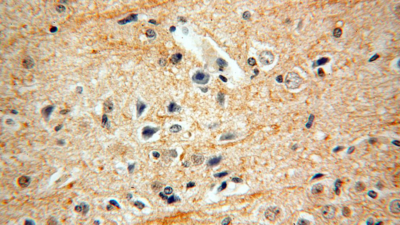 Immunohistochemical of paraffin-embedded human brain using Catalog No:110324(ENPP4 antibody) at dilution of 1:100 (under 40x lens)