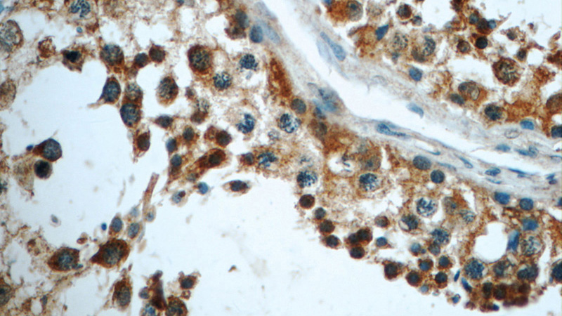 Immunohistochemistry of paraffin-embedded human testis tissue slide using Catalog No:110603(FAM8A1 Antibody) at dilution of 1:50 (under 40x lens)