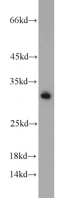 MCF7 cells were subjected to SDS PAGE followed by western blot with Catalog No:108380(BCAS2 antibody) at dilution of 1:1000