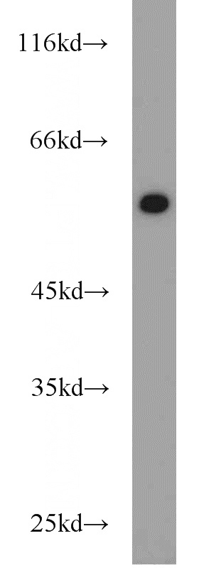 MCF7 cells were subjected to SDS PAGE followed by western blot with Catalog No:113302(NONO antibody) at dilution of 1:1000