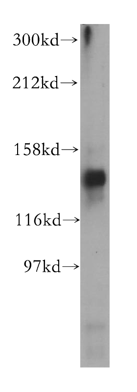 mouse testis tissue were subjected to SDS PAGE followed by western blot with Catalog No:115383(SMC6 antibody) at dilution of 1:500