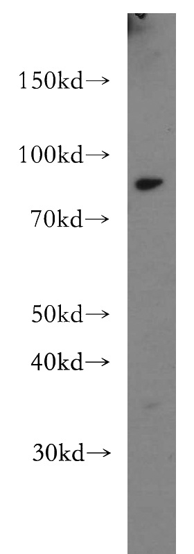mouse brain tissue were subjected to SDS PAGE followed by western blot with Catalog No:115318(SLC24A4 antibody) at dilution of 1:300