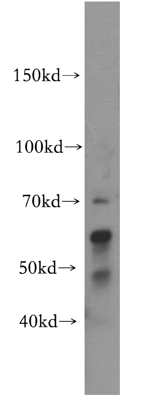 mouse cerebellum tissue were subjected to SDS PAGE followed by western blot with Catalog No:115567(SPHK2 antibody) at dilution of 1:300