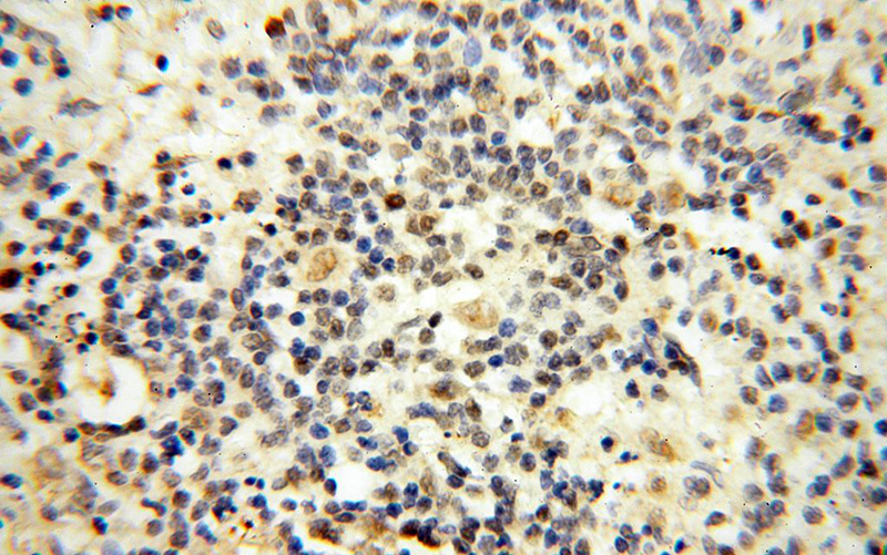 Immunohistochemical of paraffin-embedded human spleen using Catalog No:112869(MSH6 antibody) at dilution of 1:100 (under 40x lens)