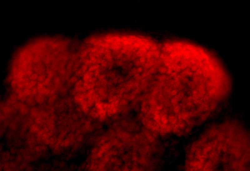 IF result of SIX2 antibody (Catalog No:115250, 1:200) with mouse embryonic kidney rudiment dissected at E13.5 and cultured for 2 days by Dr. Aleksandra Rak-Raszewska. SIX2 positive cells (red) in condense metanephric mesenchyme surrounding the ureteric bud tip.