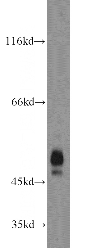 HeLa cells were subjected to SDS PAGE followed by western blot with Catalog No:117046(ZFYVE19 antibody) at dilution of 1:2000