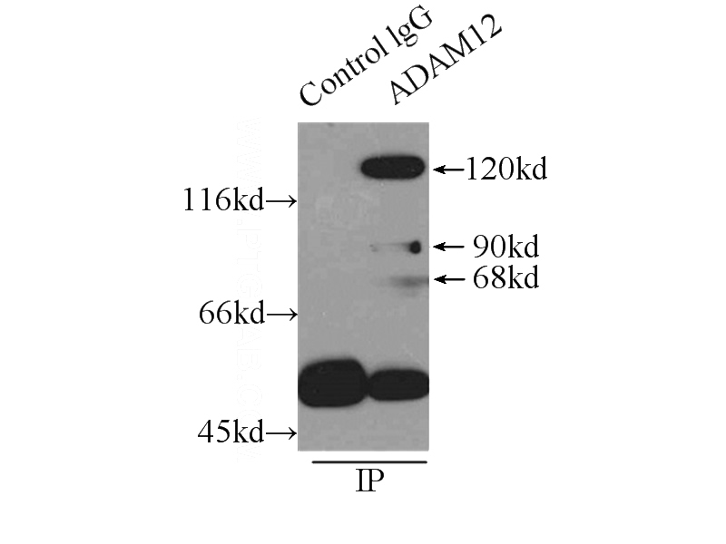 IP Result of anti-ADAM12 (IP:Catalog No:107761, 4ug; Detection:Catalog No:107761 1:300) with HeLa cells lysate 4650ug.