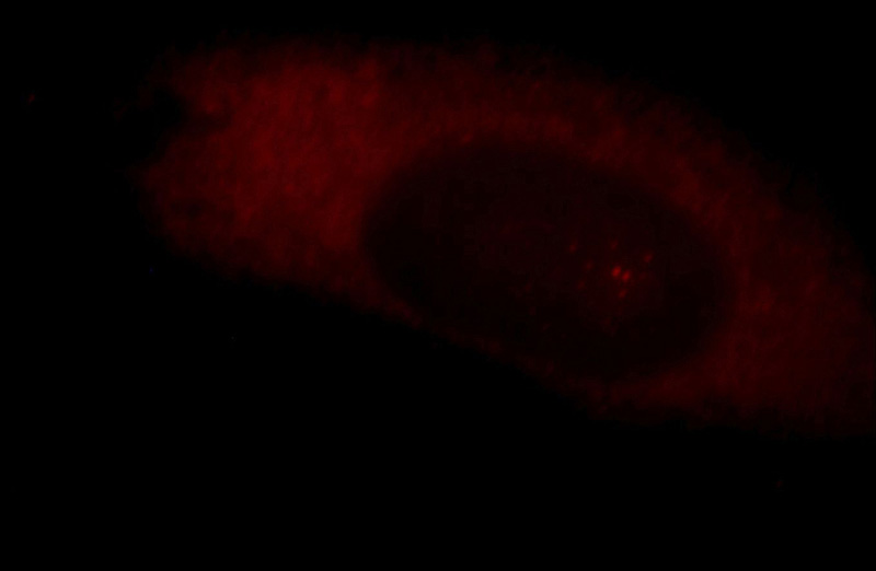 Immunofluorescent analysis of Hela cells, using CLASP1 antibody Catalog No:109333 at 1:25 dilution and Rhodamine-labeled goat anti-rabbit IgG (red).
