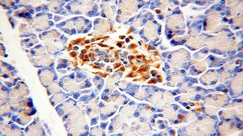 Immunohistochemical of paraffin-embedded human pancreas using Catalog No:110793(FKTN antibody) at dilution of 1:100 (under 40x lens)