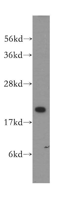 HeLa cells were subjected to SDS PAGE followed by western blot with Catalog No:116776(VPS25 antibody) at dilution of 1:500