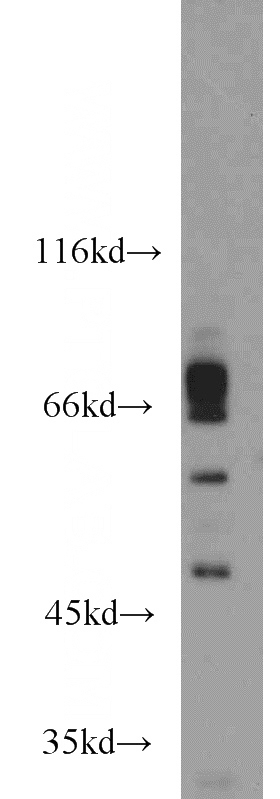 Jurkat cells were subjected to SDS PAGE followed by western blot with Catalog No:111596(ICOSLG antibody) at dilution of 1:1500
