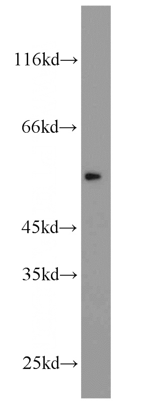 human liver tissue were subjected to SDS PAGE followed by western blot with Catalog No:109284(CHRNB1 antibody) at dilution of 1:300