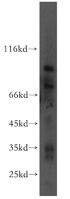HepG2 cells were subjected to SDS PAGE followed by western blot with Catalog No:116699(UVRAG antibody) at dilution of 1:500