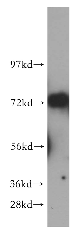 human kidney tissue were subjected to SDS PAGE followed by western blot with Catalog No:116839(WRAP53 antibody) at dilution of 1:300