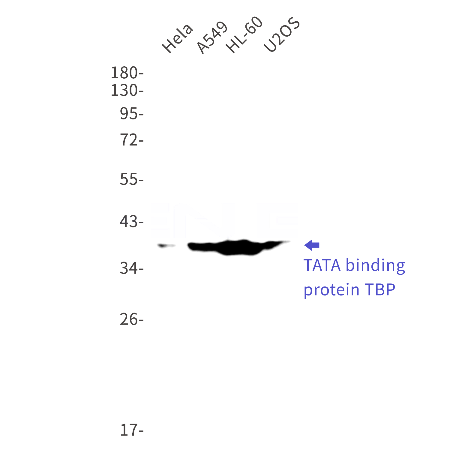 Western blot detection of TATA binding protein TBP in Hela,A549,HL-60,U2OS cell lysates using TATA binding protein TBP Rabbit mAb(1:1000 diluted).Predicted band size:38kDa.Observed band size:38kDa.