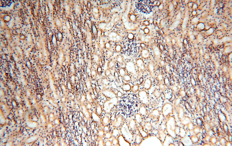 Immunohistochemical of paraffin-embedded human kidney using Catalog No:112840(MRPS11 antibody) at dilution of 1:100 (under 10x lens)