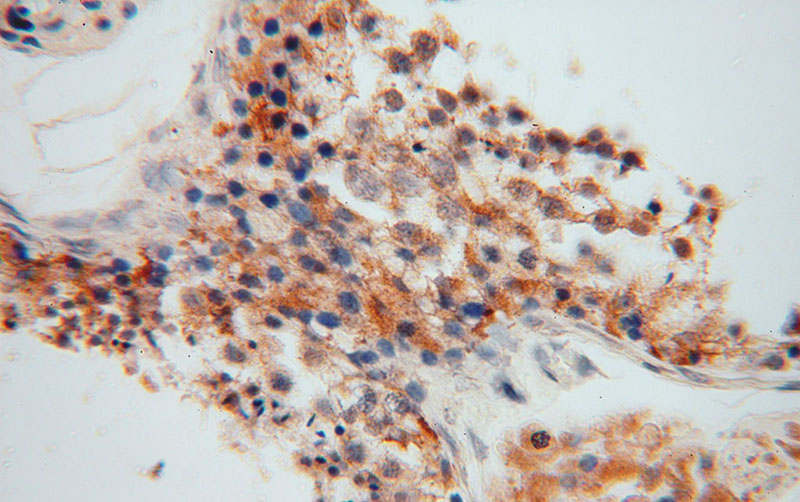 Immunohistochemical of paraffin-embedded human testis using Catalog No:109655(CYB5B antibody) at dilution of 1:100 (under 40x lens)