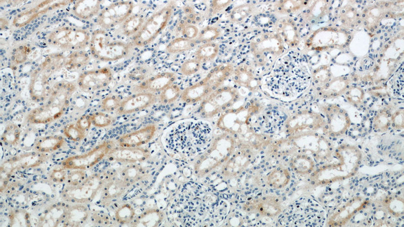 Immunohistochemical of paraffin-embedded human kidney using Catalog No:111491(HMOX1 antibody) at dilution of 1:50 (under 10x lens)
