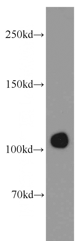 HepG2 cells were subjected to SDS PAGE followed by western blot with Catalog No:111600(IDE antibody) at dilution of 1:300