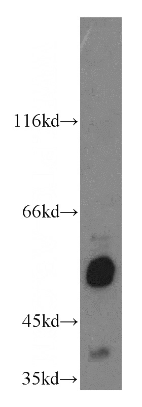 mouse liver tissue were subjected to SDS PAGE followed by western blot with Catalog No:117061(SLC39A7 antibody) at dilution of 1:500