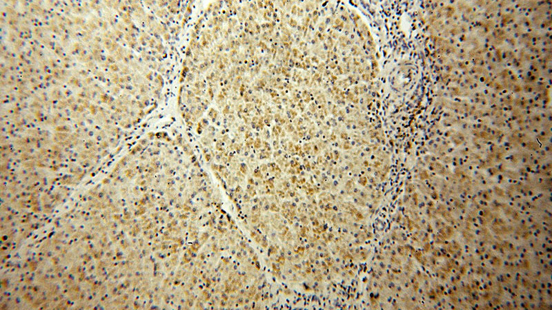 Immunohistochemical of paraffin-embedded human liver using Catalog No:114769(RNMTL1 antibody) at dilution of 1:100 (under 10x lens)