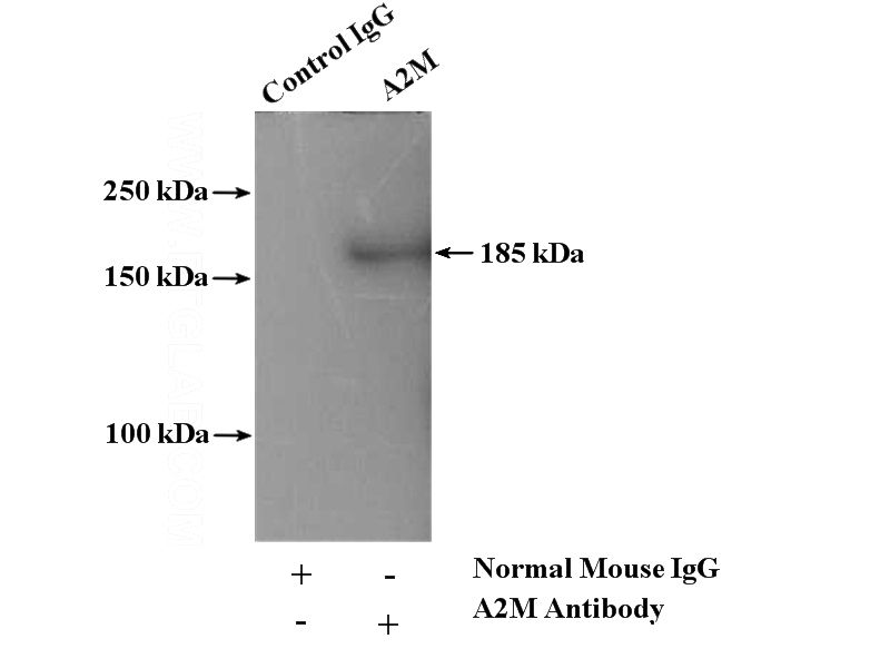 IP Result of anti-A2M (IP:Catalog No:107581, 5ug; Detection:Catalog No:107581 1:500) with human plasma tissue lysate 4000ug.