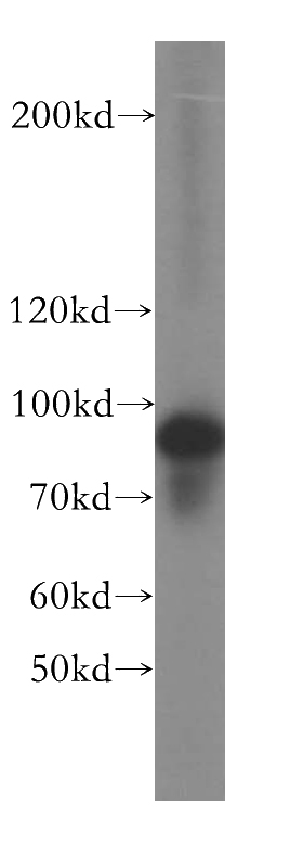 A431 cells were subjected to SDS PAGE followed by western blot with Catalog No:115868(TBC1D5 antibody) at dilution of 1:400
