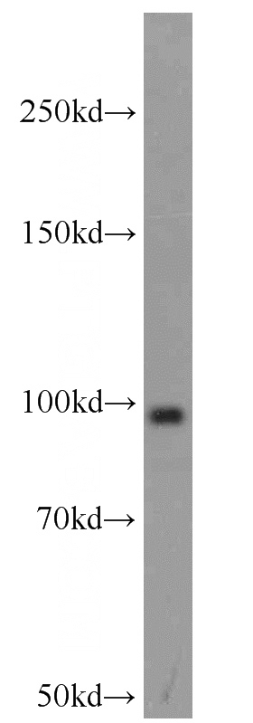 MCF7 cells were subjected to SDS PAGE followed by western blot with Catalog No:110910(KAT2A antibody) at dilution of 1:800
