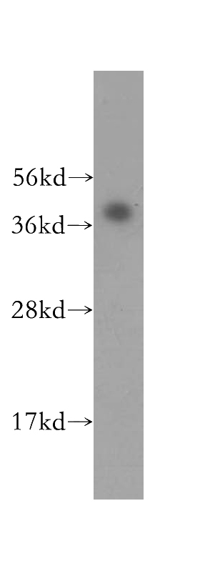 human skeletal muscle tissue were subjected to SDS PAGE followed by western blot with Catalog No:111943(hIST1 antibody) at dilution of 1:300