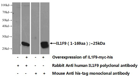 Transfected HEK-293 cells were subjected to SDS PAGE followed by western blot with Catalog No:111739(IL1F9 Antibody) at dilution of 1:1000