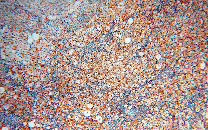 Immunohistochemical of paraffin-embedded human ovary using Catalog No:114554(RBM8A,Y14 antibody) at dilution of 1:100 (under 10x lens)
