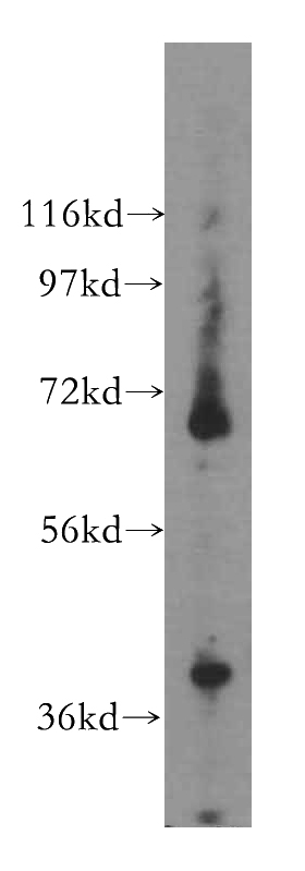 HeLa cells were subjected to SDS PAGE followed by western blot with Catalog No:115583(SRF antibody) at dilution of 1:400