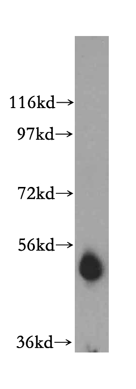 human heart tissue were subjected to SDS PAGE followed by western blot with Catalog No:107776(ADAT1 antibody) at dilution of 1:1000