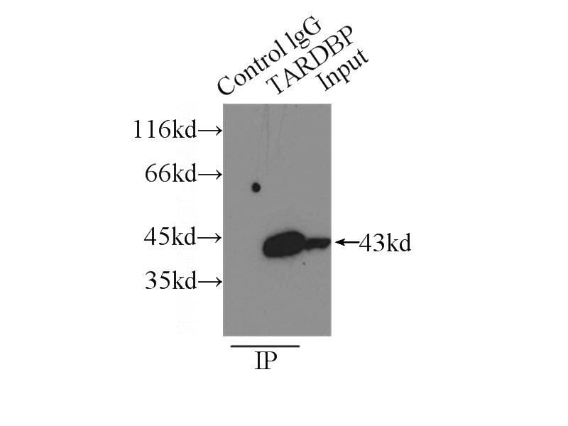 IP Result of anti-TARDBP (IP:Catalog No:115927, 3ug; Detection:Catalog No:115927 1:1500) with K-562 cells lysate 6000ug.