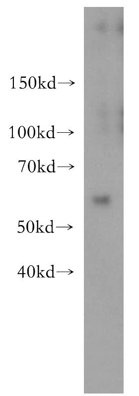 human colon tissue were subjected to SDS PAGE followed by western blot with Catalog No:112634(MEF2C antibody) at dilution of 1:300