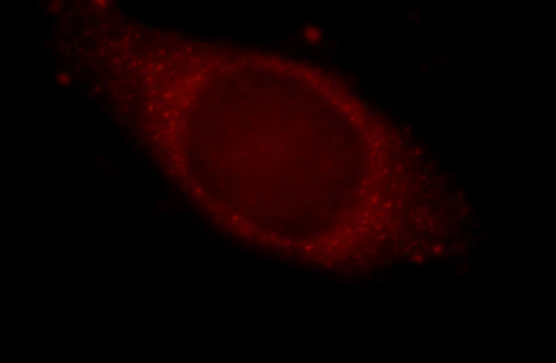 Immunofluorescent analysis of HepG2 cells, using KIAA0528 antibody Catalog No:111984 at 1:25 dilution and Rhodamine-labeled goat anti-rabbit IgG (red).