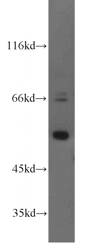 K-562 cells were subjected to SDS PAGE followed by western blot with Catalog No:115974(TADA2B antibody) at dilution of 1:1000