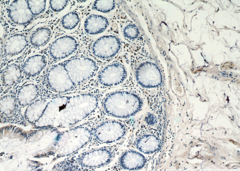 Immunohistochemistry of paraffin-embedded human colon tissue slide using Catalog No:108999(CCL17 Antibody) at dilution of 1:50 (under 10x lens)